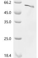 Mouse Neurogenic differentiation factor 1 (Neurod1) Recombinant Protein, N-10His/C-Myc - BioCrest Sci