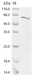 Mouse Neurogenic differentiation factor 1 (Neurod1) Recombinant Protein, N-10His/C-Myc, Mus musculus (Mouse), E.coli, N-terminal 10xHis-tagged and C-terminal Myc-tagged, 47.5 kDa, purity >≥ 85% as determined by SDS-PAGE.