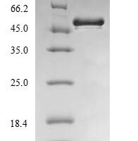 Burkholderia cenocepacia UDP-3-O-acyl-N-acetylglucosamine deacetylase (lpxC) Recombinant Protein - BioCrest Sci