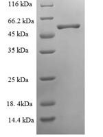 Chicken Ovoinhibitor (OIH), partial Recombinant Protein, N-His, aa 26–472, E.coli - BioCrest Sci