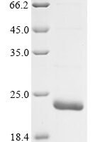 Mouse Inositol 1,4,5-triphosphate receptor associated 1 (Irag1), partial Recombinant Protein - BioCrest Sci