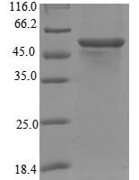 Human Steroid 17-alpha-hydroxylase/17,20 lyase (CYP17A1), partial Recombinant Protein - BioCrest Sci