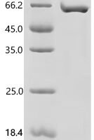 Human Metallothionein-2 (MT2A), partial Recombinant Protein, C-10His-HSA - BioCrest Sci