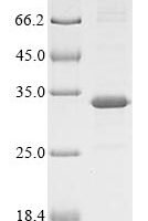 Rat Meteorin-like protein (Metrnl) Recombinant Protein, N-His - BioCrest Sci