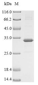 Rat Meteorin-like protein (Metrnl) Recombinant Protein, N-His, Rattus norvegicus (Rat), E.coli, N-terminal 6xHis-tagged, 33.8 kDa, purity >≥ 85% as determined by SDS-PAGE.