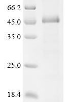 Human Atrial natriuretic peptide-converting enzyme (CORIN), partial Recombinant Protein, N-His, aa 428–801 - BioCrest Sci