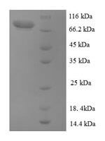 Human Extracellular calcium-sensing receptor (CASR), partial Recombinant Protein, N-GST - BioCrest Sci