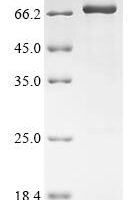 Rat Coagulation factor X (F10) Recombinant Protein, N-10His/C-Myc - BioCrest Sci