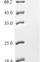 Human Cholesteryl ester transfer protein (CETP) Recombinant Protein - BioCrest Sci