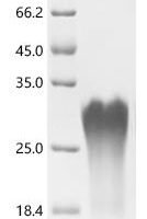 Human Enamelin (ENAM),partial Recombinant Protein - BioCrest Sci
