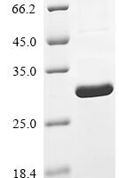 Human Bcl-2-like protein 11 (BCL2L11) Recombinant Protein, N-His, aa 1–198, E.coli - BioCrest Sci