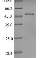 Human Regulator of G-protein signaling 17 (RGS17) Recombinant Protein - BioCrest Sci