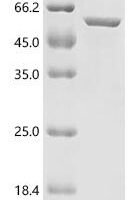 Mouse Keratin, type I cytoskeletal 17 (Krt17) Recombinant Protein - BioCrest Sci