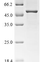 Pongo abelii Paraneoplastic antigen Ma2 homolog (PNMA2) Recombinant Protein - BioCrest Sci