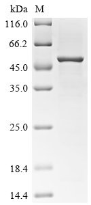 Pongo abelii Paraneoplastic antigen Ma2 homolog (PNMA2) Recombinant Protein, Pongo abelii (Sumatran orangutan) (Pongo pygmaeus abelii), E.coli, C-terminal 6xHis-tagged, 48.3 kDa, purity >≥ 85% as determined by SDS-PAGE.