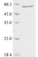 Mouse Tubulin beta-5 chain (Tubb5) Recombinant Protein - BioCrest Sci