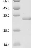 Platanus acerifolia Putative invertase inhibitor Recombinant Protein, N-His-KSI - BioCrest Sci