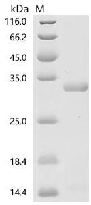 Platanus acerifolia Putative invertase inhibitor Recombinant Protein, N-His-KSI, Platanus acerifolia (London plane tree), E.coli, N-terminal 6xHis-KSI-tagged, 32.0 kDa, purity >≥ 85% as determined by SDS-PAGE.