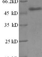 Human Zinc finger BED domain-containing protein 1 (ZBED1), partial Recombinant Protein - BioCrest Sci