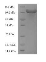 Escherichia coli Glucose-6-phosphate 1-dehydrogenase (zwf), partial Recombinant Protein - BioCrest Sci