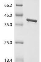 Staphylococcus aureus Staphylocoagulase, partial Recombinant Protein - BioCrest Sci