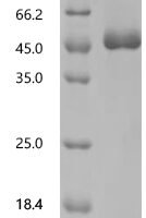 Human Adhesion G protein-coupled receptor L3 (ADGRL3), partial Recombinant Protein, C-His, aa 20–425, Homo sapiens (Human) - BioCrest Sci