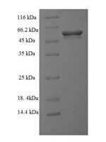 Streptomyces achromogenes Modification methylase SacI (sacIM) Recombinant Protein - BioCrest Sci