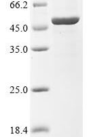 Metamycoplasma hominis Arginine deiminase (arcA) Recombinant Protein, C-10His - BioCrest Sci