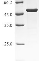 Human Serine/threonine-protein kinase LATS1 (LATS1), partial Recombinant Protein - BioCrest Sci