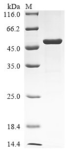 Human Serine/threonine-protein kinase LATS1 (LATS1), partial Recombinant Protein, Homo sapiens (Human), E.coli, N-terminal 10xHis-tagged and C-terminal Myc-tagged, 49.4 kDa, purity >≥ 85% as determined by SDS-PAGE.
