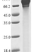 Gossypium hirsutum BEL1-like homeodomain protein 1 (BLH1) Recombinant Protein - BioCrest Sci