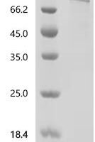 Rat Heat shock protein HSP 90-alpha (Hsp90aa1), Biotinylated Recombinant Protein - BioCrest Sci