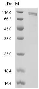 Rat Heat shock protein HSP 90-alpha (Hsp90aa1), Biotinylated Recombinant Protein, Mammalian cell, C-terminal 6xHis-Avi-tagged, 87.9 kDa, purity >≥ 90% as determined by SDS-PAGE.