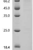 Human Polyadenylate-binding protein 1-like (PABPC1L) Recombinant Protein, C-His - BioCrest Sci