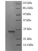 Mouse Angiopoietin-like protein 8 (Angptl8) Recombinant Protein, N-His, aa 16–198, E.coli - BioCrest Sci