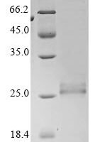 Bovine coronavirus Protein I (N) Recombinant Protein, C-His, aa 1–207, strain Mebus - BioCrest Sci