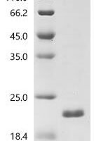 Human Transcriptional and immune response regulator (TCIM) Recombinant Protein - BioCrest Sci