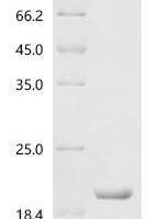 Human Fibroblast growth factor 23 (FGF23), partial Recombinant Protein - BioCrest Sci