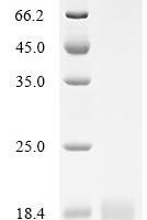 Mouse Integrin beta-1 (Itgb1), partial Recombinant Protein, N-His, aa 752–798, Mammalian cell - BioCrest Sci