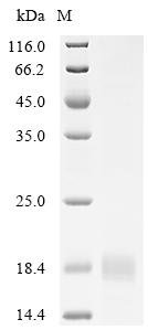 Mouse Integrin beta-1 (Itgb1), partial Recombinant Protein, N-His, aa 752–798, Mammalian cell, Mus musculus (Mouse), Mammalian cell, N-terminal 6xHis-tagged, 12.5 kDa, purity >≥ 85% as determined by SDS-PAGE.