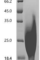 Human Seizure protein 6 homolog (SEZ6), partial Recombinant Protein, C-10His, aa 355–414, Yeast - BioCrest Sci
