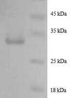 Human Pro-epidermal growth factor (EGF), partial Recombinant Protein, N-GST - BioCrest Sci