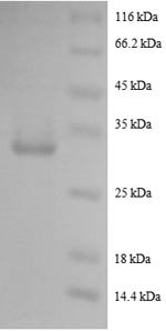 Human Pro-epidermal growth factor (EGF), partial Recombinant Protein, N-GST, Homo sapiens (Human), E.coli, N-terminal GST-tagged, 32.6 kDa, purity >≥ 90% as determined by SDS-PAGE.