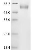 Human Collagen alpha-1 (XV) chain (COL15A1), partial Recombinant Protein - BioCrest Sci