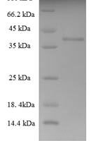 Human THAP domain-containing protein 6 (THAP6) Recombinant Protein - BioCrest Sci