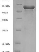 Staphylococcus aureus 3-oxoacyl-[acyl-carrier-protein] synthase 2 (fabF) Recombinant Protein - BioCrest Sci