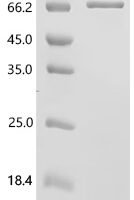 Mouse Peroxisome proliferator-activated receptor gamma (Pparg) Recombinant Protein, N-10His - BioCrest Sci