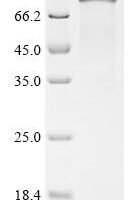 Human Segment polarity protein dishevelled homolog DVL-1 (DVL1) Recombinant Protein - BioCrest Sci
