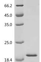 Mouse Fatty acid-binding protein, adipocyte (Fabp4) Recombinant Protein, C-3xHA - BioCrest Sci