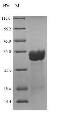 Human Centrin-2 (CETN2) Recombinant Protein - BioCrest Sci